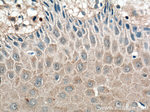 IL1 beta Antibody in Immunohistochemistry (Paraffin) (IHC (P))