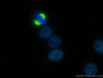SRF Antibody in Immunocytochemistry (ICC/IF)