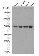SRF Antibody in Western Blot (WB)