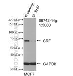 SRF Antibody in Western Blot (WB)