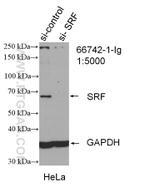 SRF Antibody in Western Blot (WB)