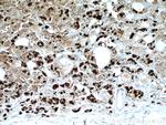 TSH beta Antibody in Immunohistochemistry (Paraffin) (IHC (P))