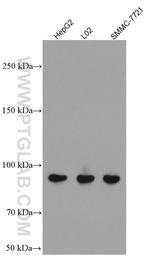 PLA2G4D Antibody in Western Blot (WB)