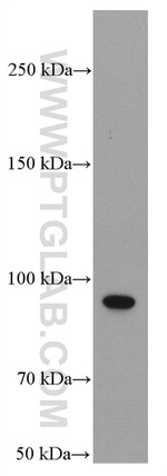 PLA2G4D Antibody in Western Blot (WB)