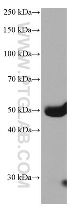 Factor X Antibody in Western Blot (WB)