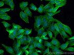 DR6 Antibody in Immunocytochemistry (ICC/IF)