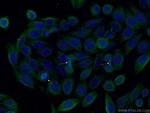AURKA Antibody in Immunocytochemistry (ICC/IF)