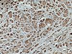 AURKA Antibody in Immunohistochemistry (Paraffin) (IHC (P))