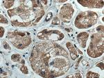 AURKA Antibody in Immunohistochemistry (Paraffin) (IHC (P))