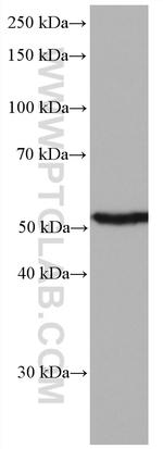 AURKA Antibody in Western Blot (WB)