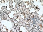 BACH1 Antibody in Immunohistochemistry (Paraffin) (IHC (P))