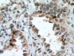 BACH1 Antibody in Immunohistochemistry (Paraffin) (IHC (P))