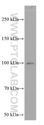BACH1 Antibody in Western Blot (WB)