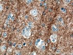 CD90 Antibody in Immunohistochemistry (Paraffin) (IHC (P))