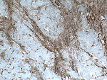 CD90 Antibody in Immunohistochemistry (Paraffin) (IHC (P))
