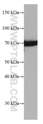 HSPA1L Antibody in Western Blot (WB)