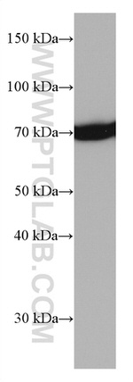 HSPA1L Antibody in Western Blot (WB)