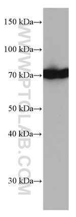 HSPA1L Antibody in Western Blot (WB)