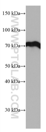 HSPA1L Antibody in Western Blot (WB)