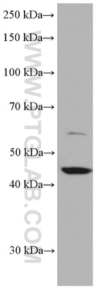 FNTB Antibody in Western Blot (WB)