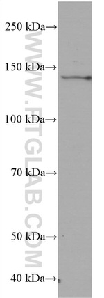 RGS3 Antibody in Western Blot (WB)