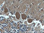 CDR2L Antibody in Immunohistochemistry (Paraffin) (IHC (P))