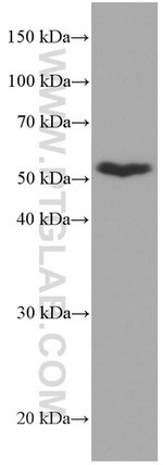 CDR2L Antibody in Western Blot (WB)