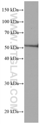 CDR2L Antibody in Western Blot (WB)