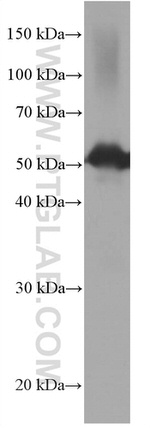 CDR2L Antibody in Western Blot (WB)