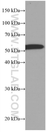 CDR2L Antibody in Western Blot (WB)