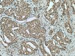 TRBP Antibody in Immunohistochemistry (Paraffin) (IHC (P))