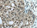 TRBP Antibody in Immunohistochemistry (Paraffin) (IHC (P))