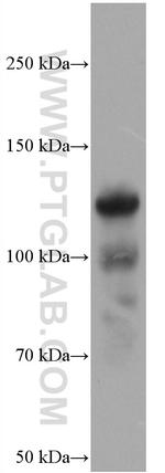 COMP Antibody in Western Blot (WB)