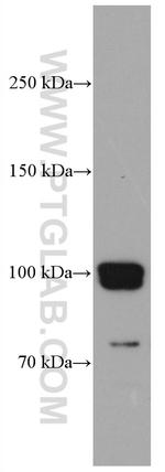 CNKSR1 Antibody in Western Blot (WB)