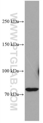 CNKSR1 Antibody in Western Blot (WB)