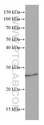 Bcl2 Antibody in Western Blot (WB)