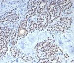 FOXL2 Recombinant Rabbit Monoclonal Antibody (FOXL2/7989R)