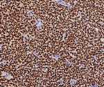 FOXL2 Antibody in Immunohistochemistry (Paraffin) (IHC (P))