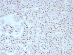 FOXL2 Recombinant Rabbit Monoclonal Antibody (FOXL2/8701R)