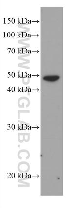 Cytokeratin 16 Antibody in Western Blot (WB)