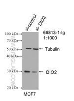 DIO2 Antibody in Western Blot (WB)