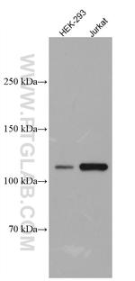 USP4 Antibody in Western Blot (WB)
