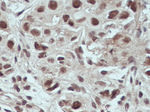 USP4 Antibody in Immunohistochemistry (Paraffin) (IHC (P))
