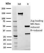 Spastin Monoclonal Antibody (Sp 3G11-1)