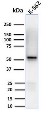 Spastin Monoclonal Antibody (Sp 6C6)