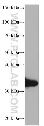 APOE Antibody in Western Blot (WB)