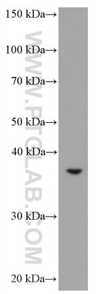ASGR2 Antibody in Western Blot (WB)