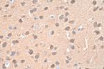 CAMK2 Antibody in Immunohistochemistry (Paraffin) (IHC (P))