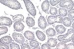 TDRKH Antibody in Immunohistochemistry (Paraffin) (IHC (P))