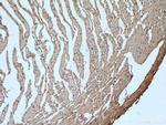 GLUT4 Antibody in Immunohistochemistry (Paraffin) (IHC (P))